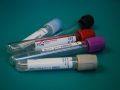 Biochemical blood test: transcript