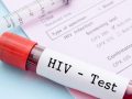 AIDS: Symptoms, Treatment and Prevention