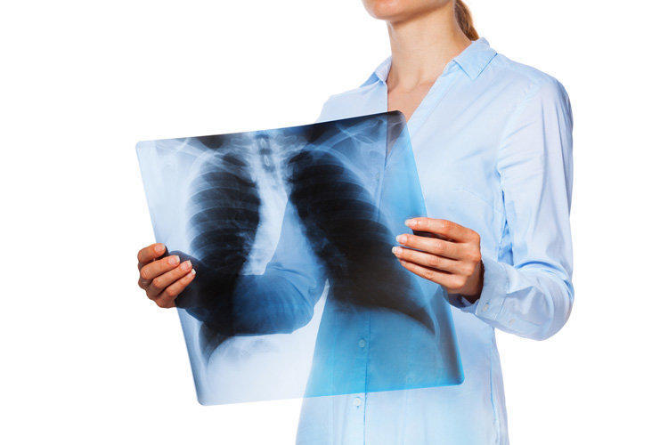 Tuberculosis: Symptoms, Causes, Treatment and Prevention