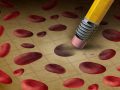 Anemia: causes, types, diagnosis, prevention
