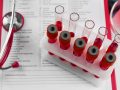 What indicators of a general blood test indicate oncology