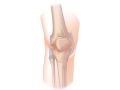 Experimental drug prevented cartilage loss in osteoarthritis